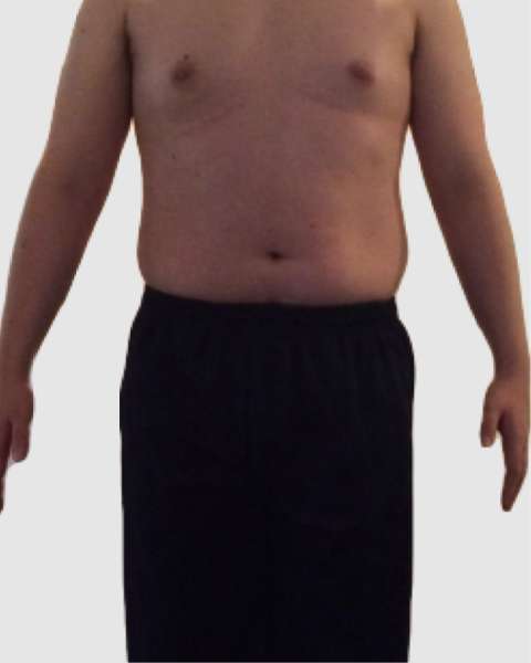 体型のビフォー画像